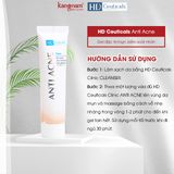  Tinh chất đặc trị mụn, kiểm soát nhờn HD Ceuticals Anti Acne 30ml 