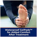  Kem loại bỏ mụn cóc Compound W Nitrofreeze + Gel Pads 