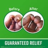  Kem dưỡng da tay O'Keeffe's Working Hands Cream 96g 