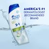  Dầu gội xả Head & Shoulders Green Apple 2 in 1 12.5oz 370ml 