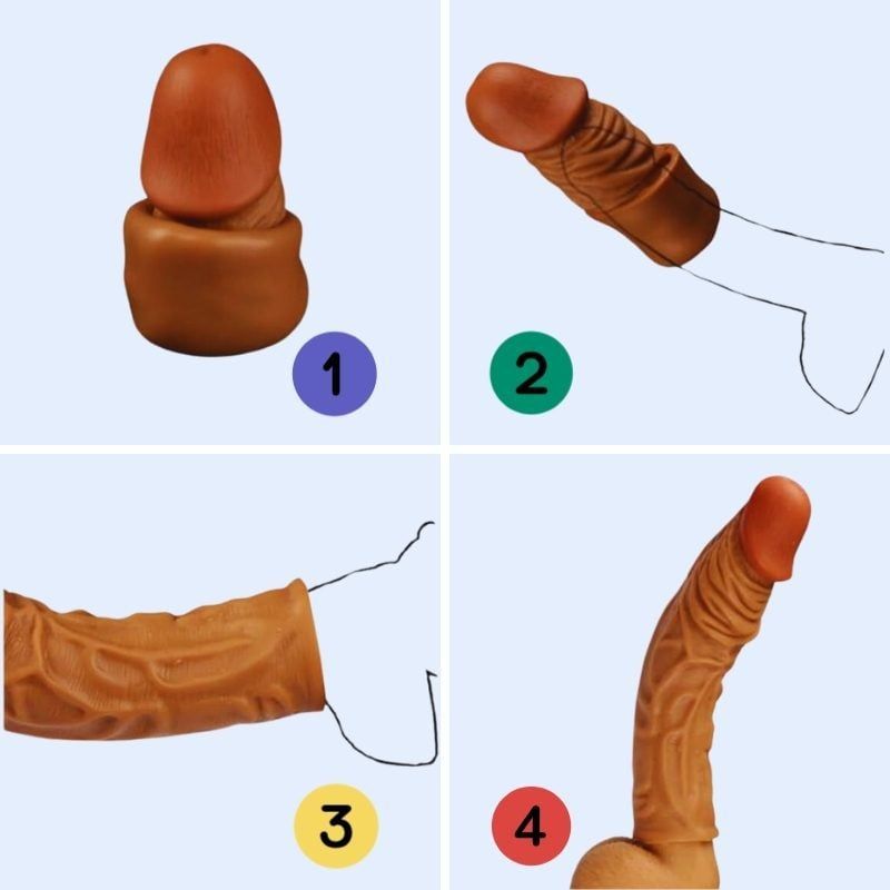  Đôn Dên Tăng Kích Thước Top Notch Reinforcing Gân 