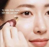  Kem giúp giảm nhăn vùng mắt Whoo Intensive Wrinkle Concentrate 