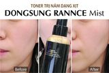  Xịt khoáng dưỡng trắng da mờ thâm nám Dongsung Rannce Mist 150ml Hàn Quốc 