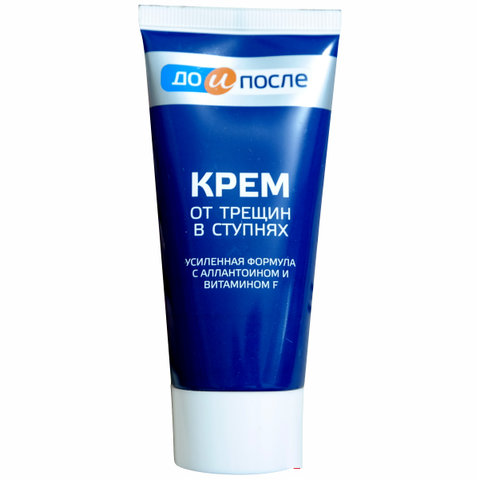 KPEM Kem Nứt Gót Chân