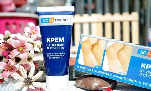 KPEM Kem Nứt Gót Chân