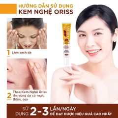 Kem Nghệ Giảm Mụn Mờ Thâm Liền Sẹo Oriss (tuýp 20g)