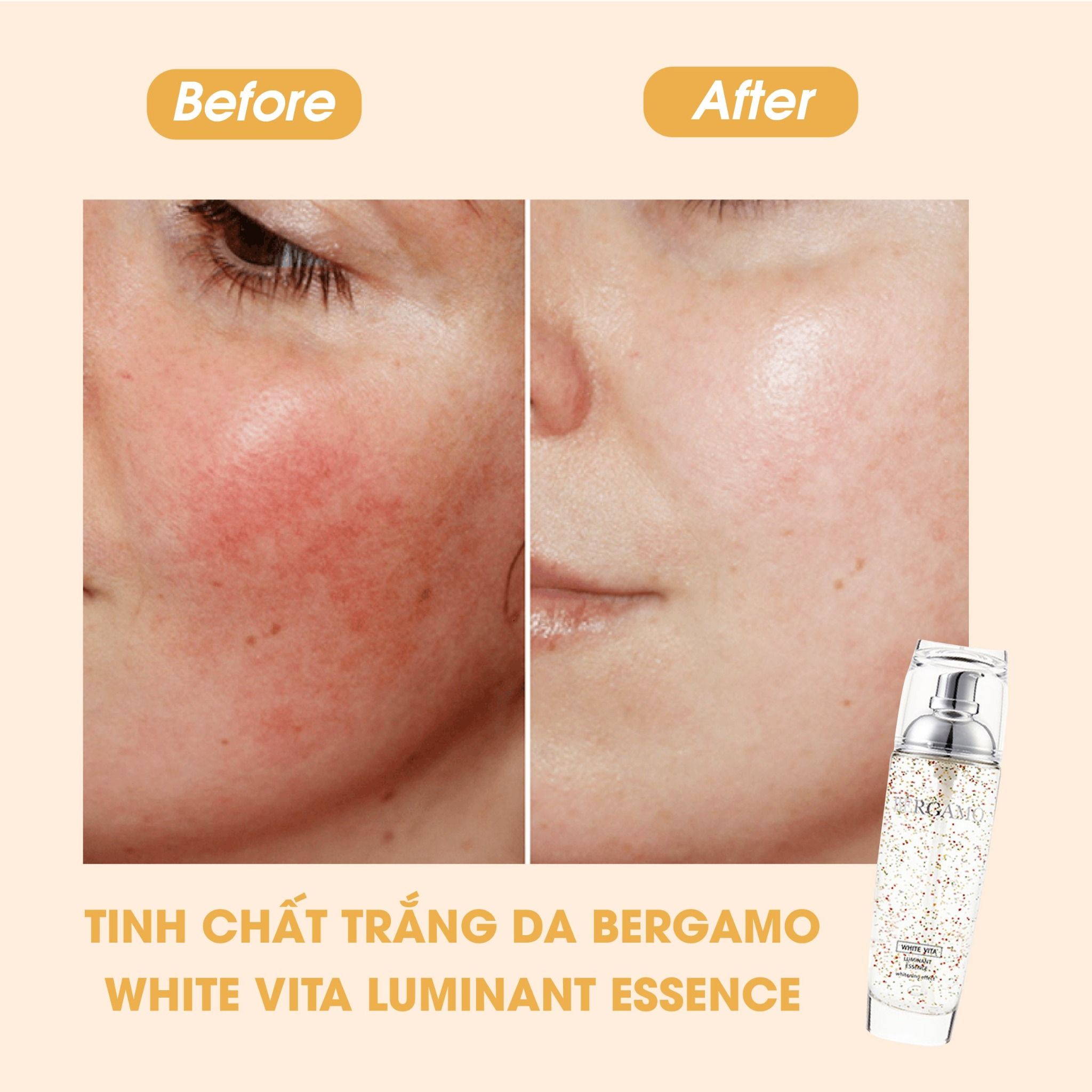 TINH CHẤT SÁNG DA BERGAMO WHITE VITA LUMINANT ESSENCE 110ML