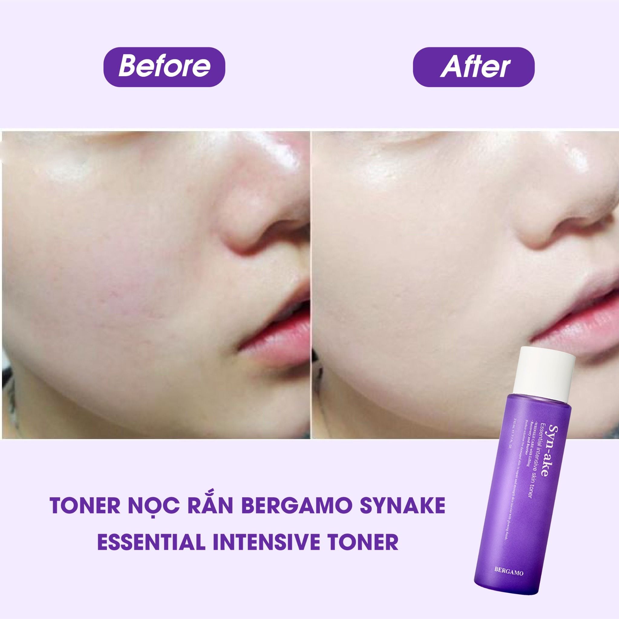 TONER NỌC RẮN BERGAMO SYNAKE ESSENTIAL INTENSIVE TONER 210ML