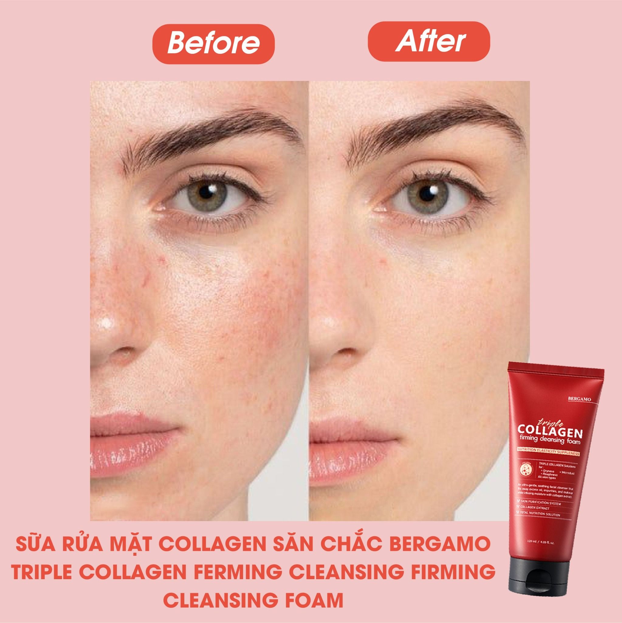 SỮA RỬA MẶT COLLAGEN SĂN CHẮC BERGAMO TRIPLE COLLAGEN FIRMING CLEANSING FOAM 120ML