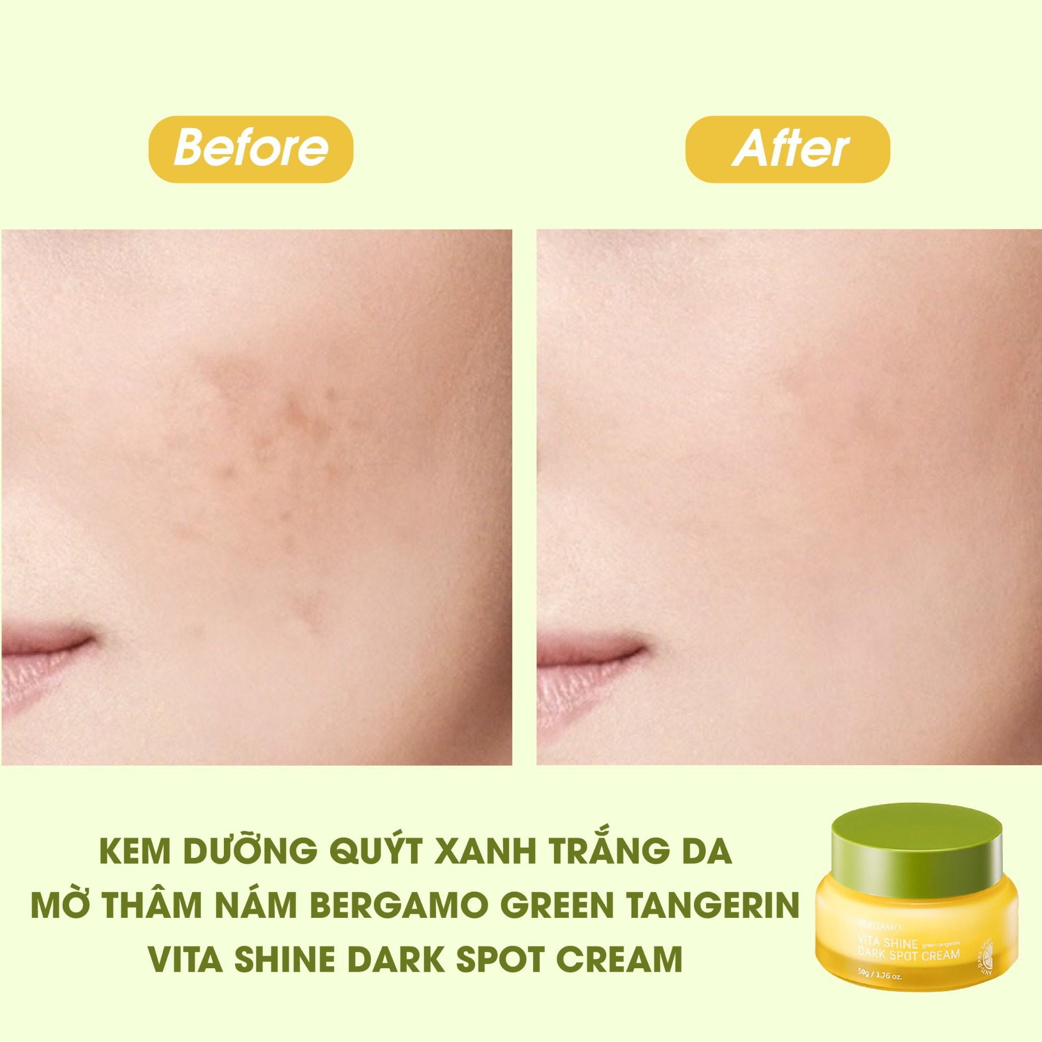 KEM DƯỠNG QUÝT XANH SÁNG DA MỜ THÂM NÁM BERGAMO GREEN TANGERINE VITA SHINE DARK SPOT CREAM 50G