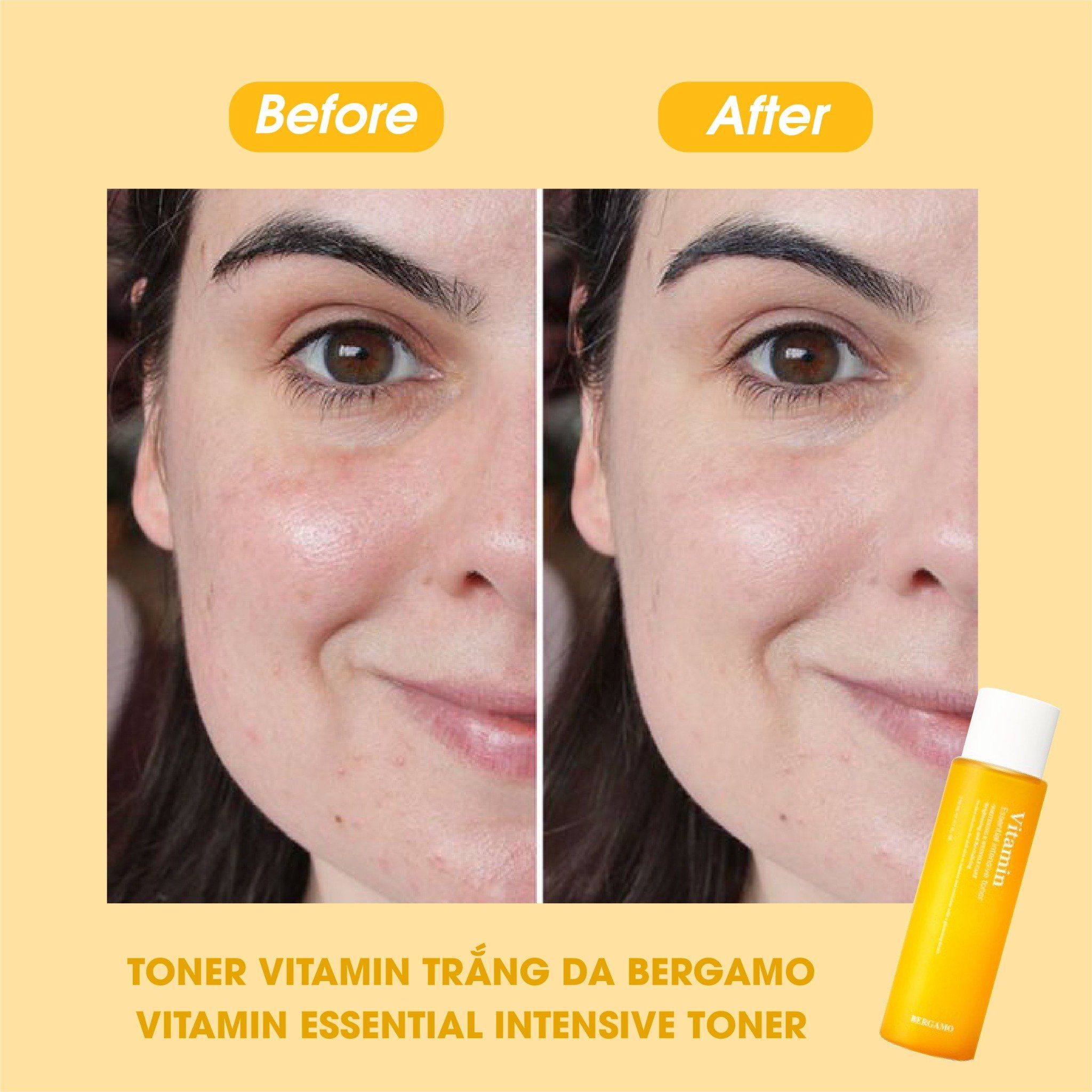 TONER VITAMIN SÁNG DA BERGAMO VITAMIN ESSENTIAL INTENSIVE TONER 210ML