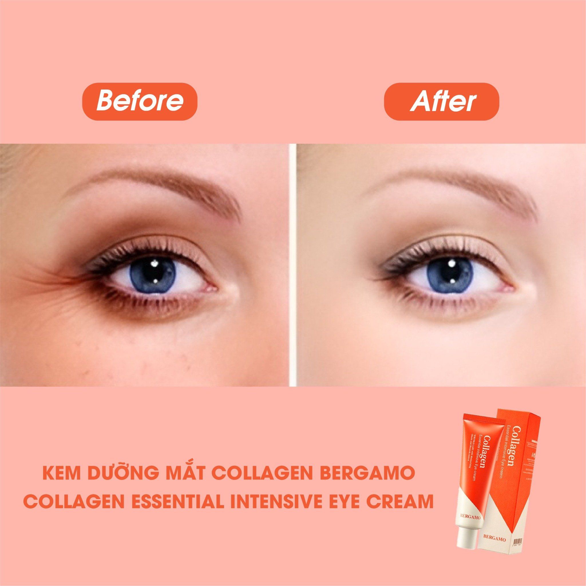 KEM DƯỠNG MẮT COLLAGEN BERGAMO COLLAGEN ESSENTIAL INTENSIVE EYE CREAM 100G