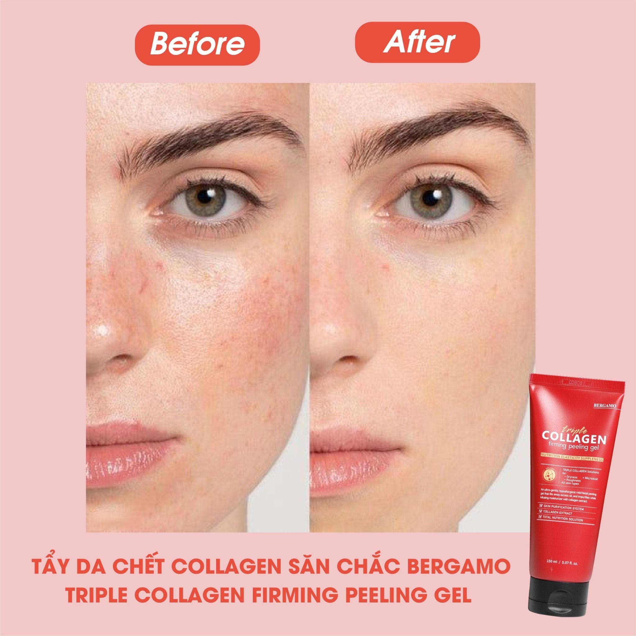 TẨY DA CHẾT COLLAGEN SĂN CHẮC BERGAMO TRIPLE COLLAGEN FIRMING PEELING GEL 150ML