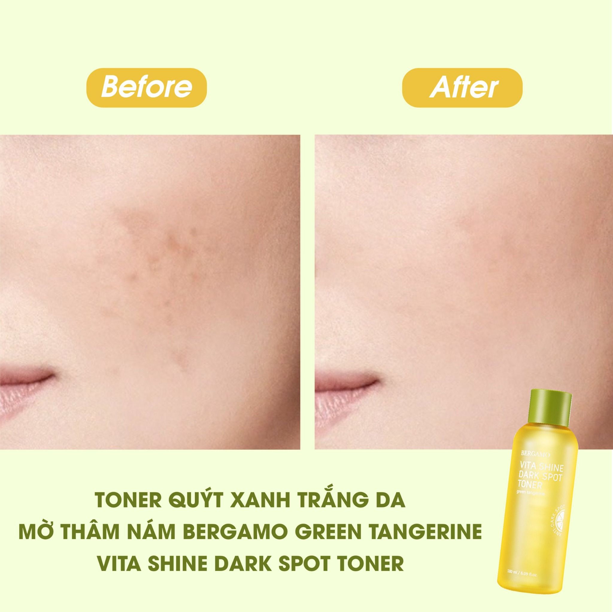 TONER QUÝT XANH SÁNG DA MỜ THÂM NÁM BERGAMO GREEN TANGERINE VITA SHINE DARK SPOT TONER 180ML