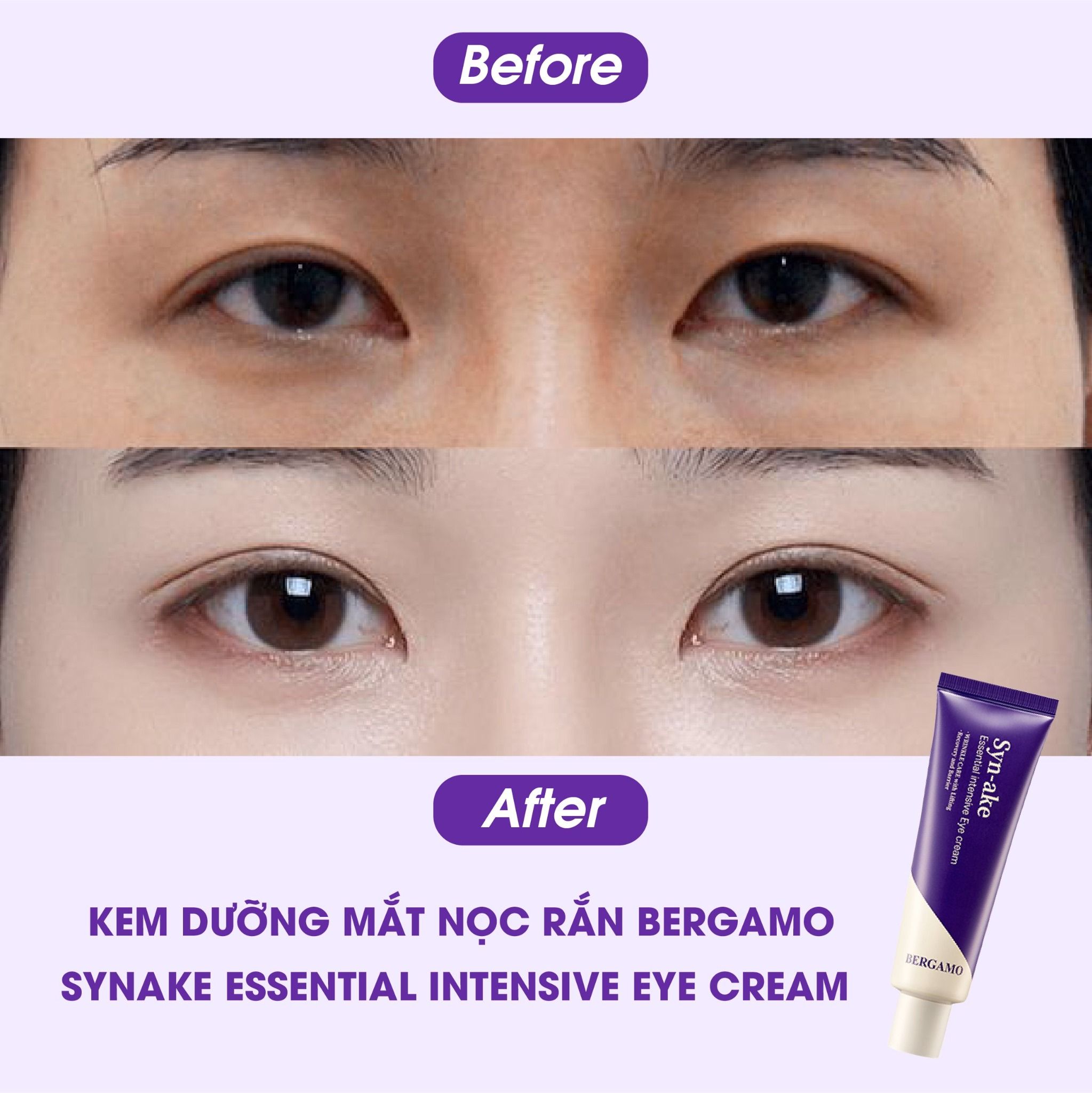 KEM DƯỠNG MẮT TINH CHẤT NỌC RẮN BERGAMO SYNAKE ESSENTIAL INTENSIVE EYE CREAM 100G
