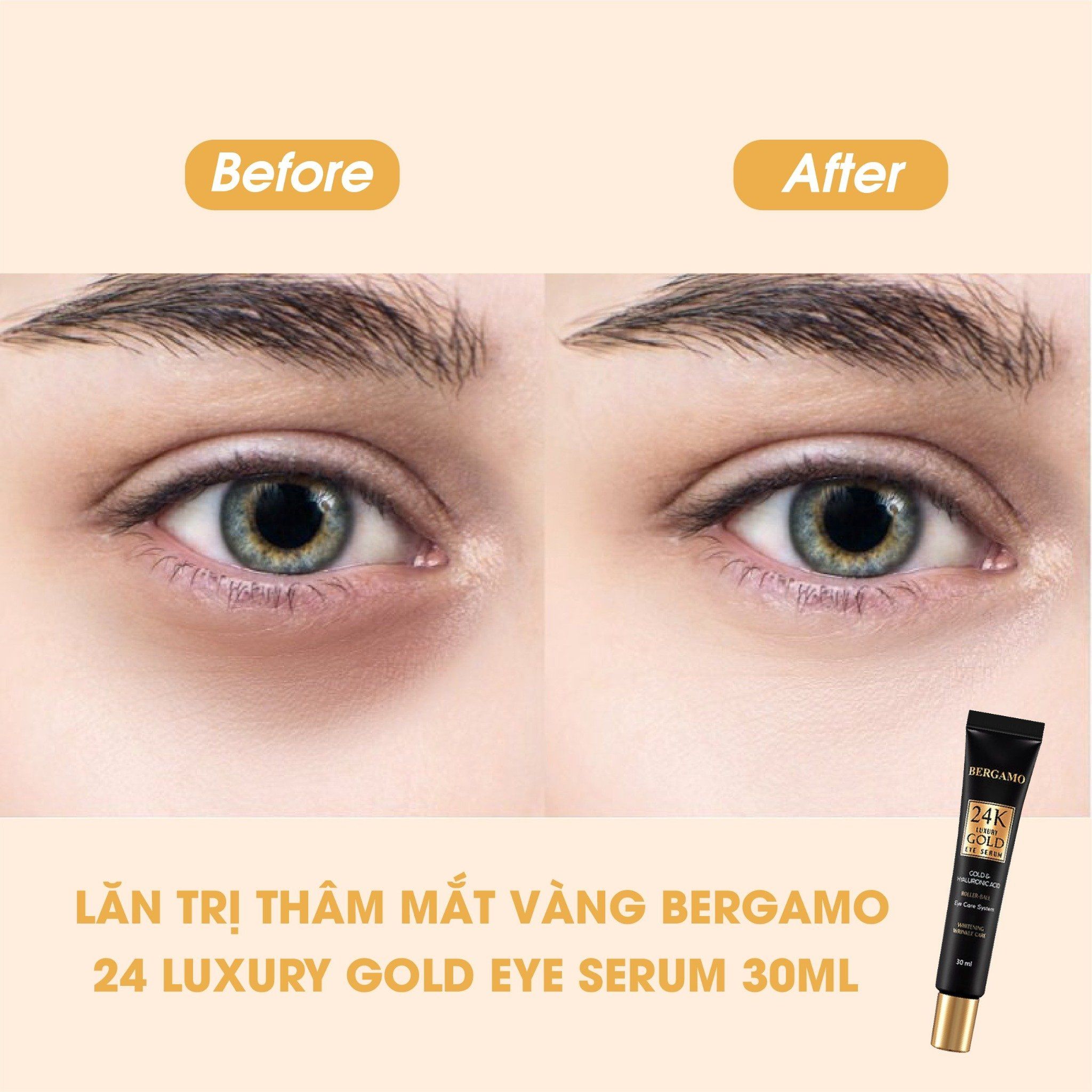 LĂN GIẢM THÂM MẮT VÀNG BERGAMO 24K LUXURY GOLD 30ML
