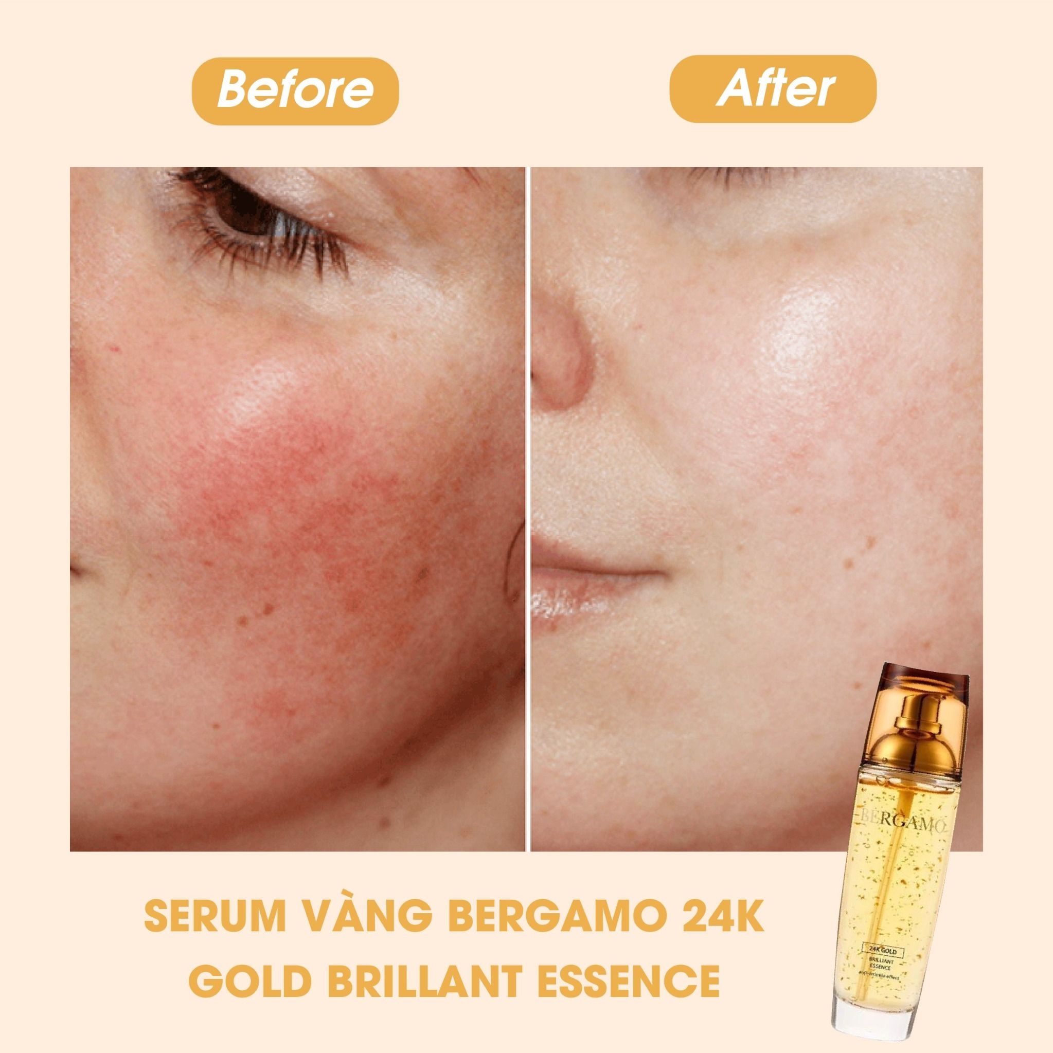 TINH CHẤT VÀNG BERGAMO 24K GOLD BRILLIANT ESSENCE 110ML