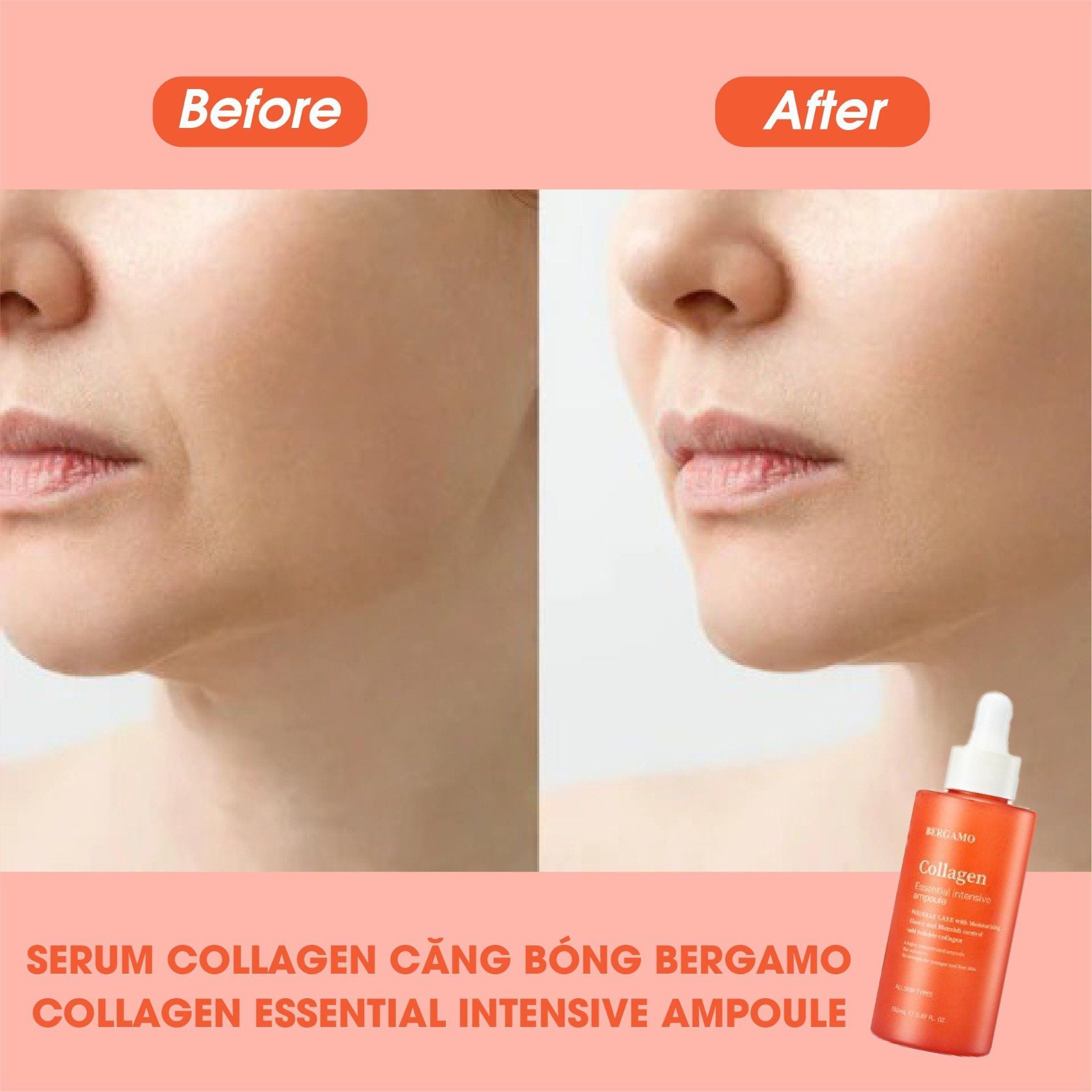 SERUM COLLAGEN CĂNG BÓNG BERGAMO COLLAGEN ESSENTIAL INTENSIVE AMPOULE 150ML
