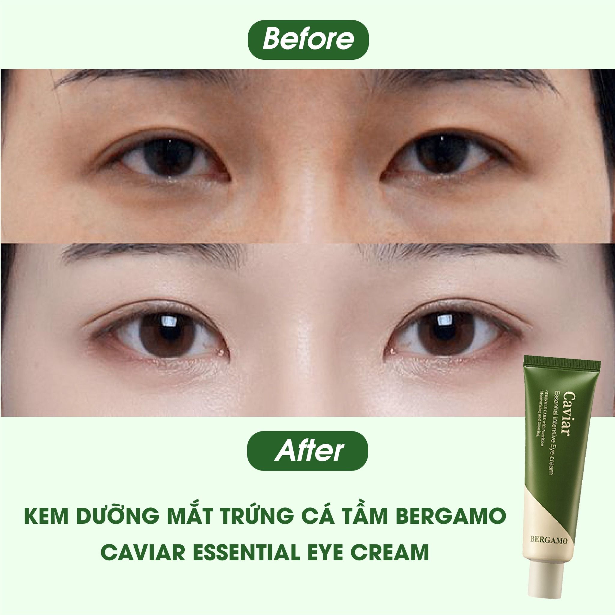 KEM DƯỠNG MẮT TRỨNG CÁ TẦM BERGAMO CAVIAR ESSENTIAL INTENSIVE EYE CREAM 100G