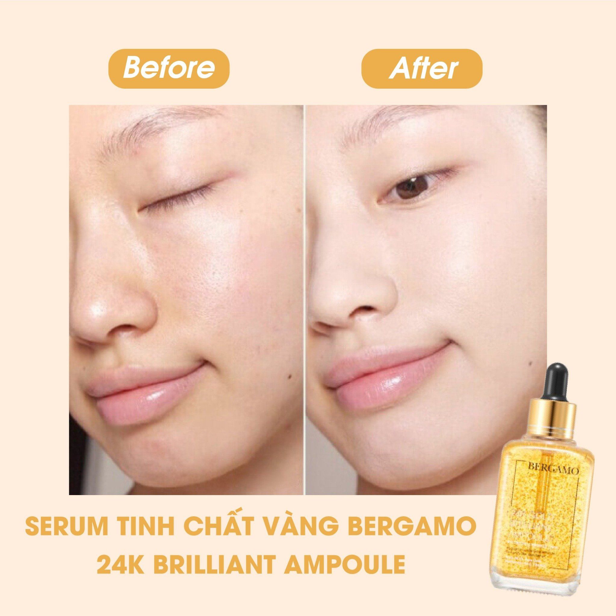 TINH CHẤT VÀNG BERGAMO 24K GOLD BRILLIANT AMPOULE 90ML