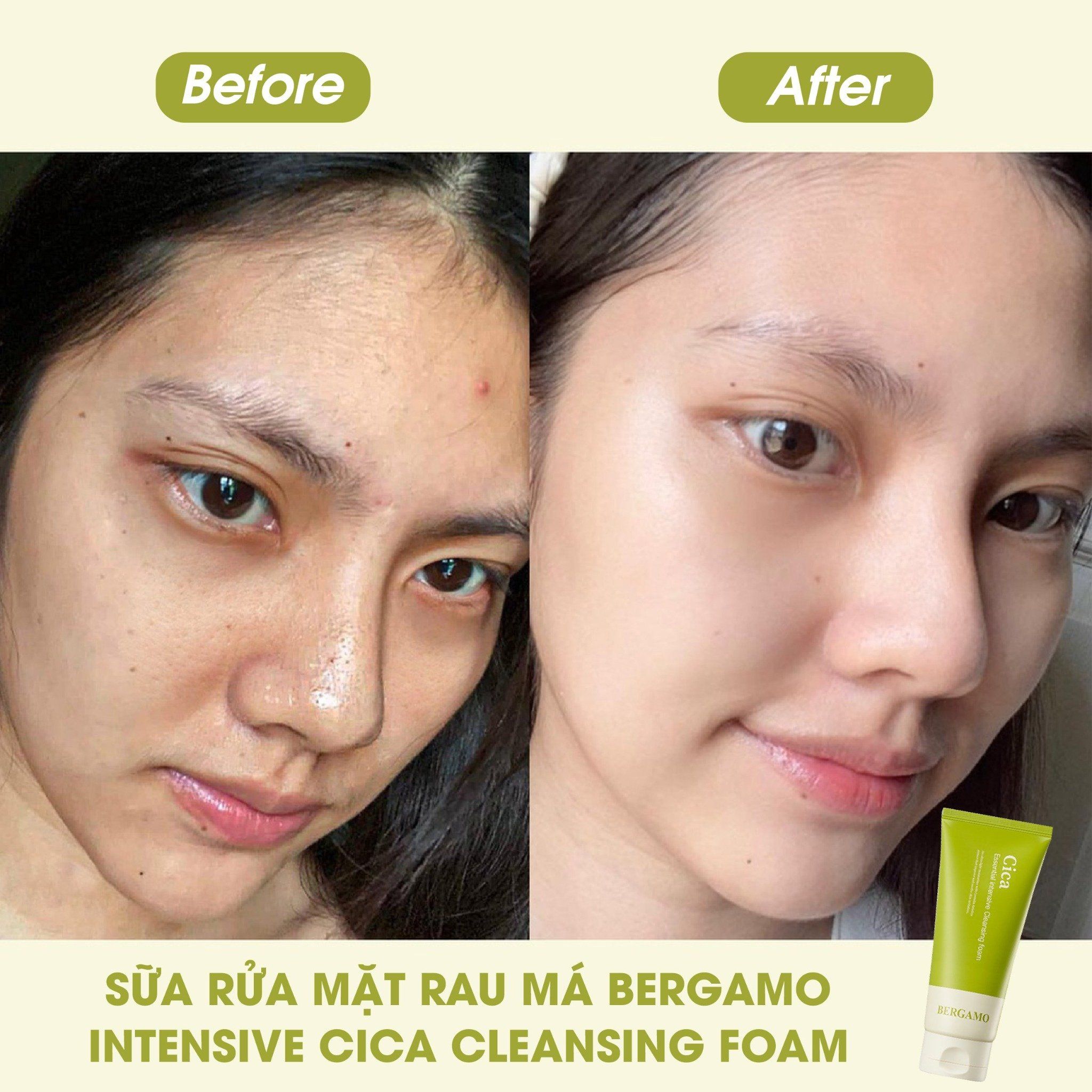 SỮA RỬA MẶT RAU MÁ BERGAMO CICA ESSENTIAL INTENSIVE CLEANSING FOAM 120ML