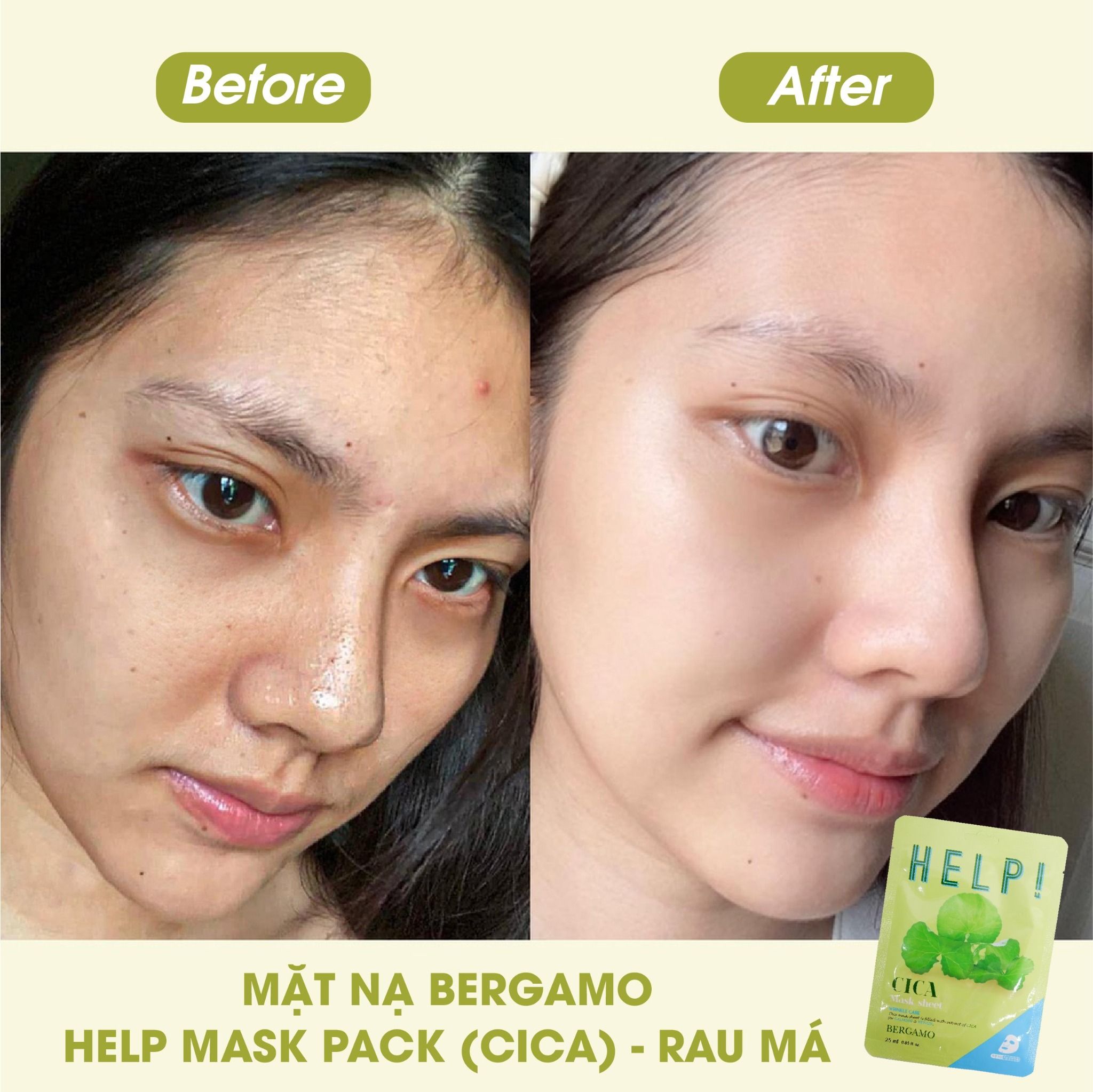 MẶT NẠ BERGAMO HELP MASK PACK CICA - RAU MÁ