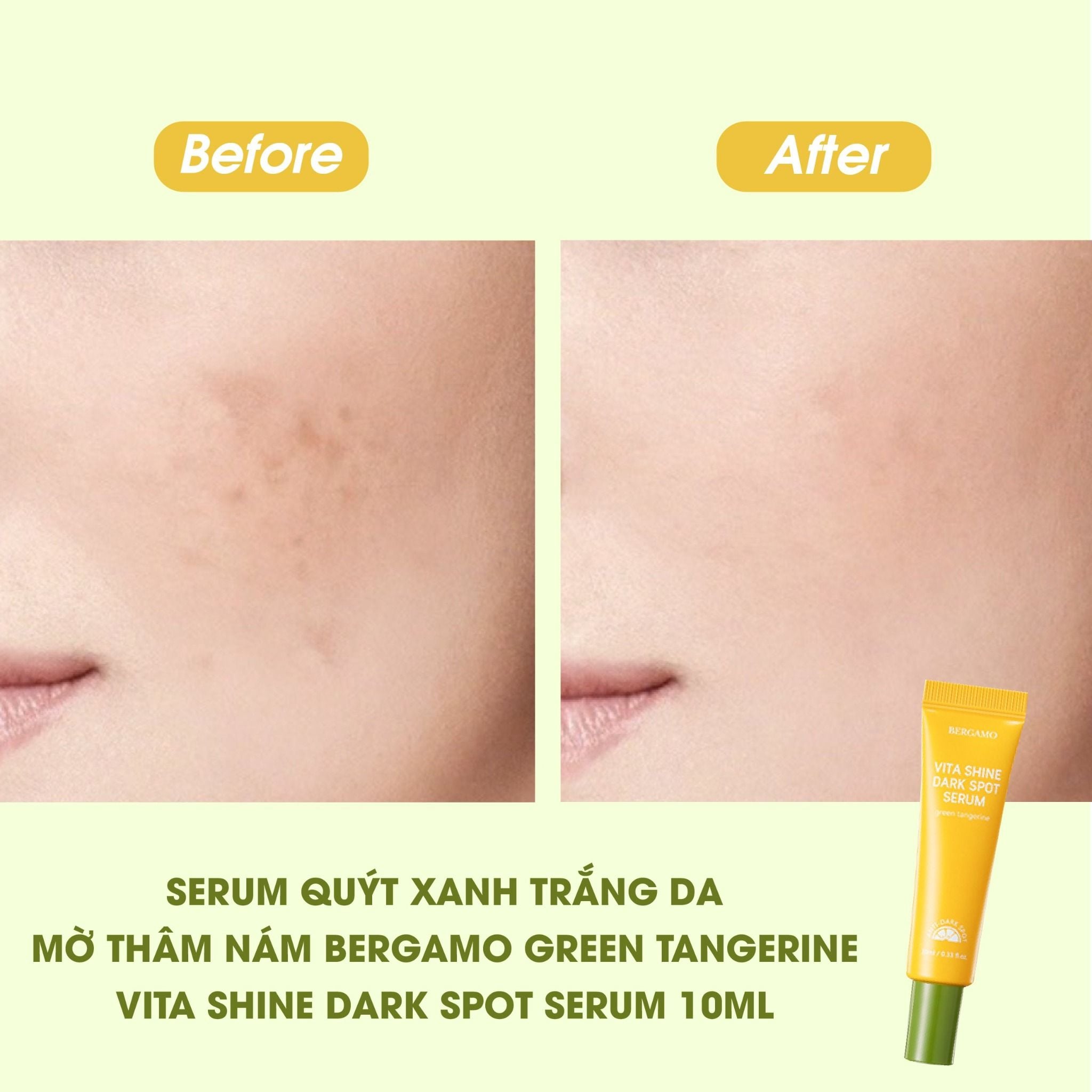 SERUM QUÝT XANH SÁNG DA MỜ THÂM NÁM BERGAMO GREEN TANGERINE VITA SHINE DARK SPOT SERUM 10ML