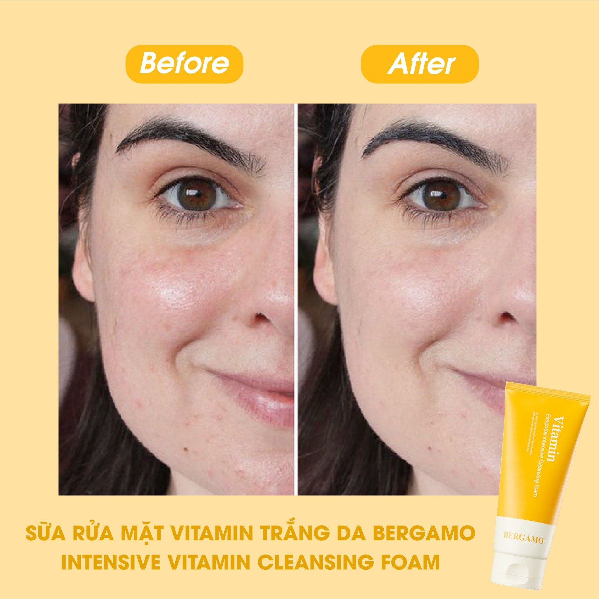SỮA RỬA MẶT VITAMIN SÁNG DA BERGAMO INTENSIVE VITAMIN CLEANSING FOAM 120ML