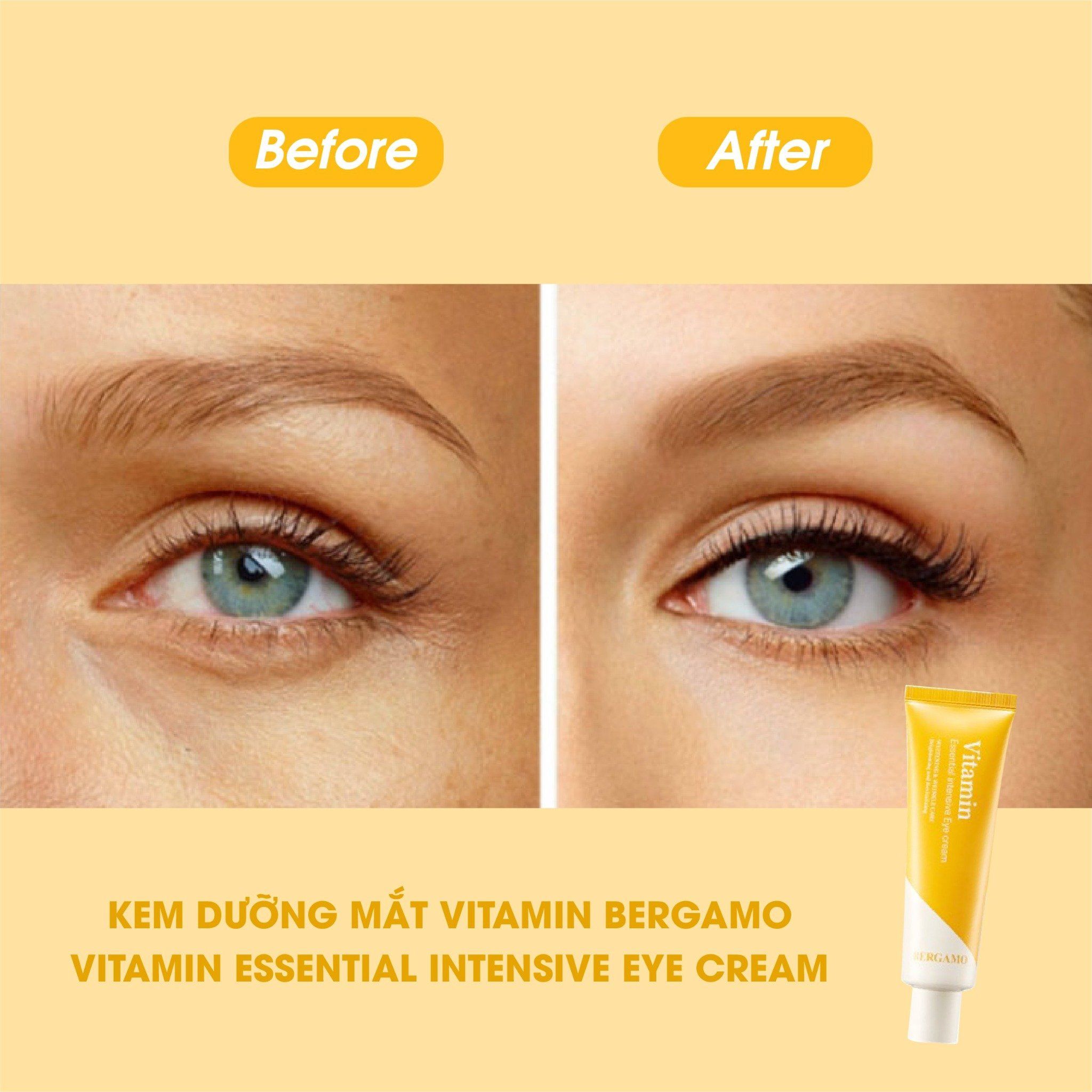 KEM DƯỠNG MẮT VITAMIN BERGAMO VITAMIN ESSENTIAL INTENSIVE EYECREAM 100G
