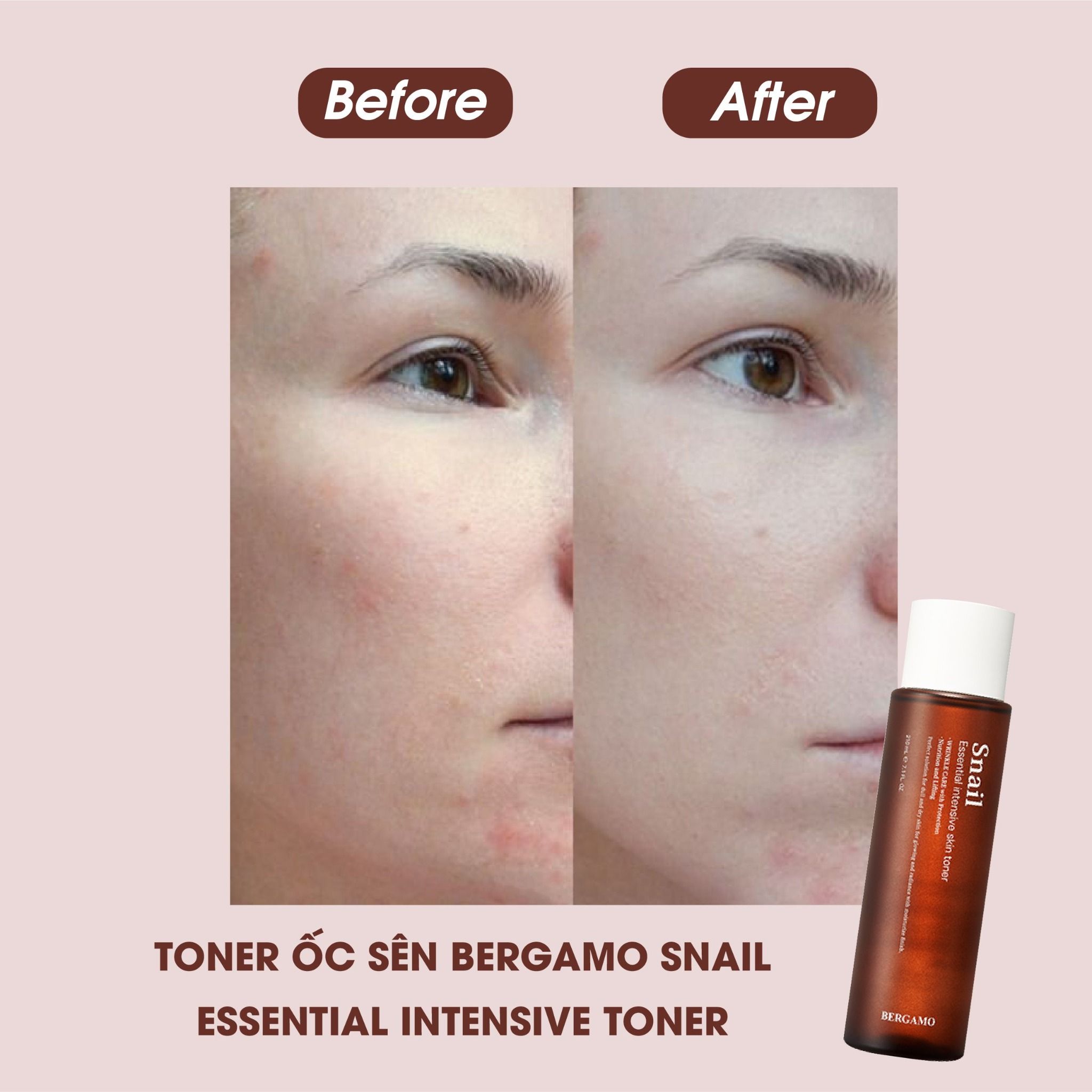 TONER ỐC SÊN BERGAMO SNAIL ESSENTIAL INTENSIVE TONER 210ML