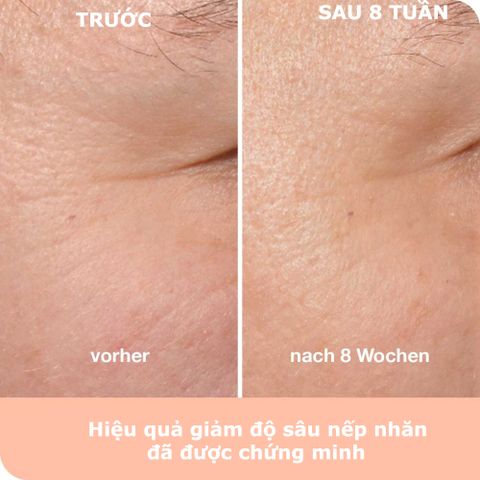  Viên uống ngăn ngừa lão hóa da dermatoLoges wellAging với hyaluron, 60 viên 