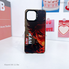 Ốp Xiaomi Mi 11 lite lưng cứng Kamado nút bạc