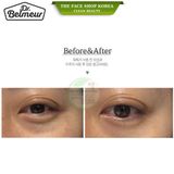  Mặt nạ mắt Hydrogel giảm quầng thâm và nếp nhăn Dr. Belmeur Derma Collagen Eye Patches 
