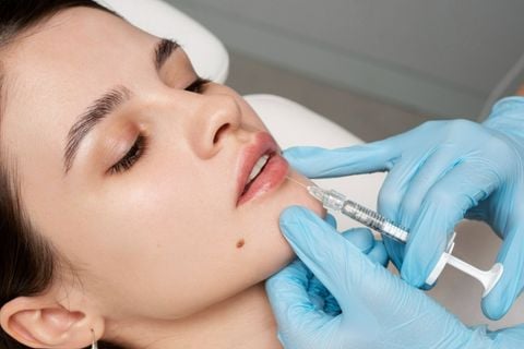 Làm đẹp bằng phương pháp filler