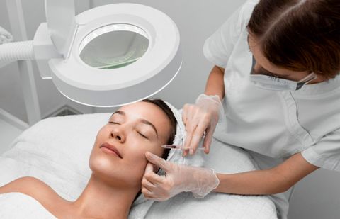  Tiêm filler hốc mắt 