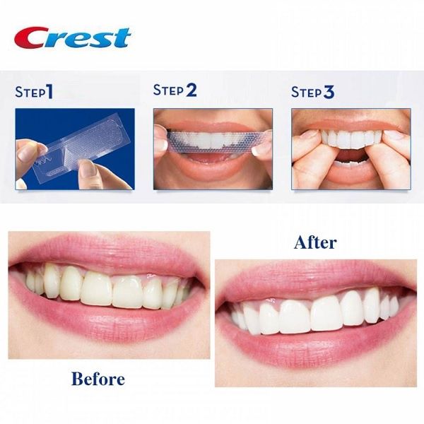 Crest 3D White Strips Dental Whitening