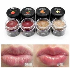 Tẩy Tế Bào Chết Môi Beauty Treats Lip Scrub - 10.5g