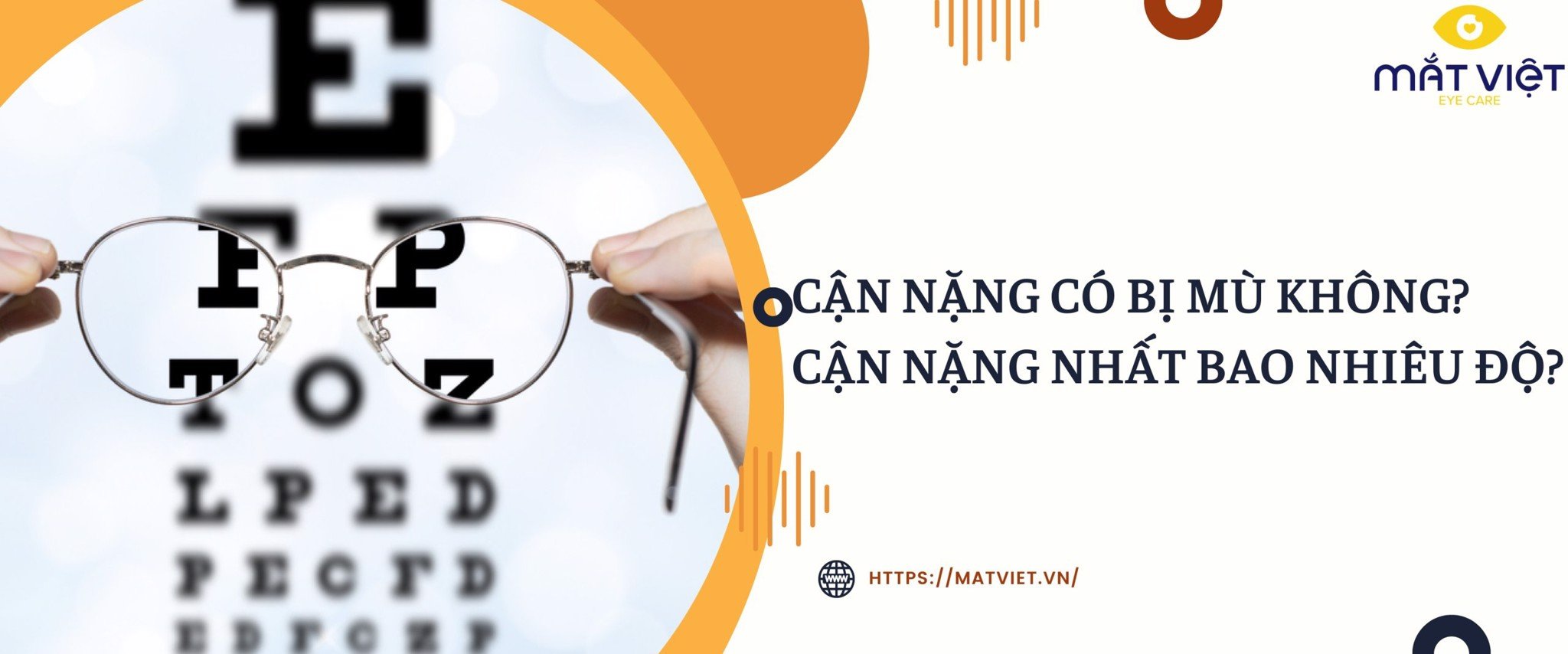 cận nặng có bị mù không