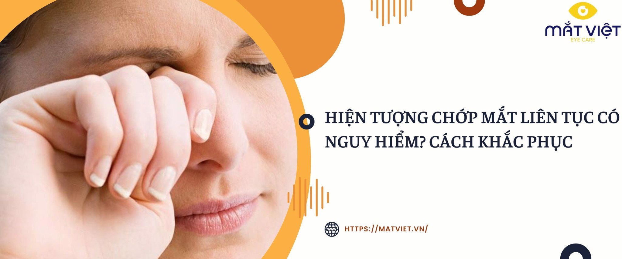 chớp mắt liên tục