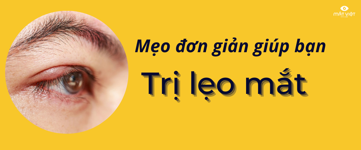 trị lẹo mắt