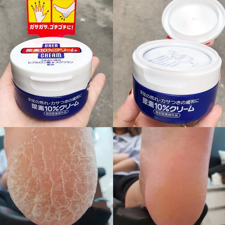 Kem trị nứt nẻ gót chân, tay Shiseido Urea Cream Nhật 100g