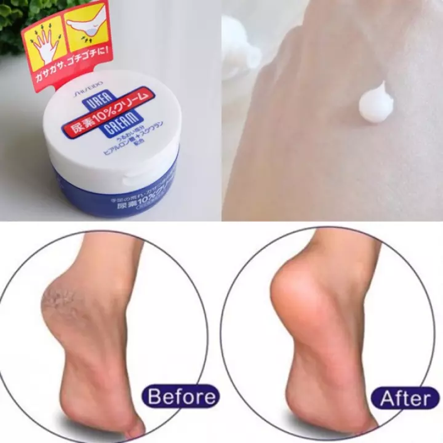 Kem trị nứt nẻ gót chân, tay Shiseido Urea Cream Nhật 100g