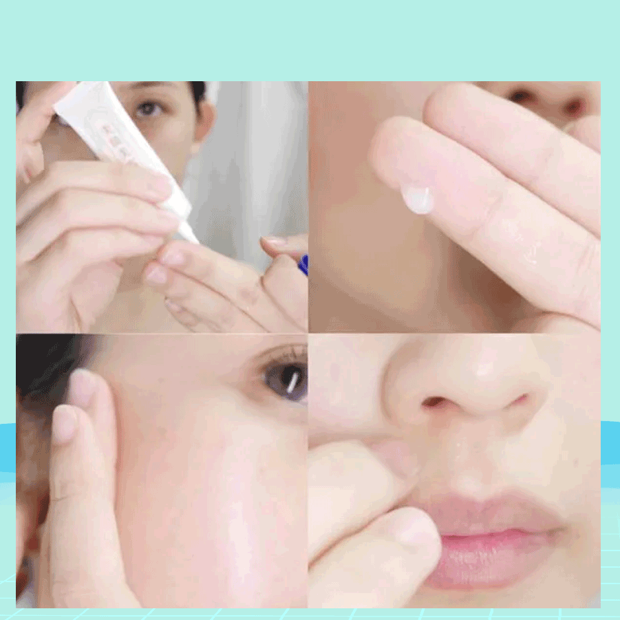 Tinh chất dưỡng ngăn ngừa mụn Bigan Meishoku 15g