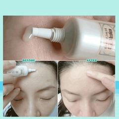 Tinh chất dưỡng ngăn ngừa mụn Bigan Meishoku 15g