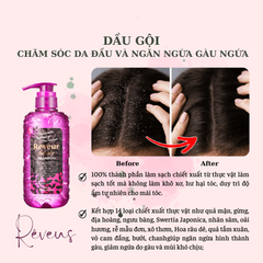 Dầu gội,dầu xả chăm sóc da đầu và ngăn ngừa gàu ngứa Rêveur 500ml
