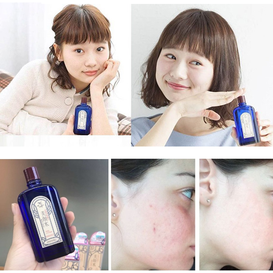 Lotion Ngăn Ngừa Mụn Meishoku Bigansui Medicated Skin (90ml)