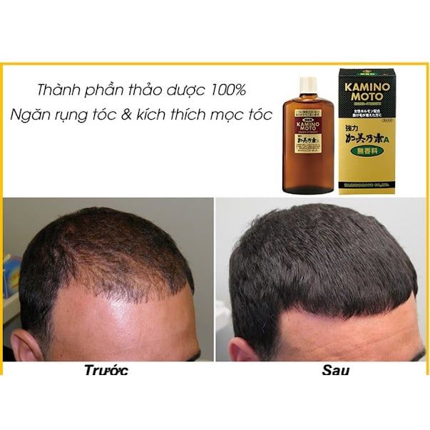 Tinh Chất Dưỡng Kích Thích Mọc Tóc Kaminomoto Nhật Bản 200ml