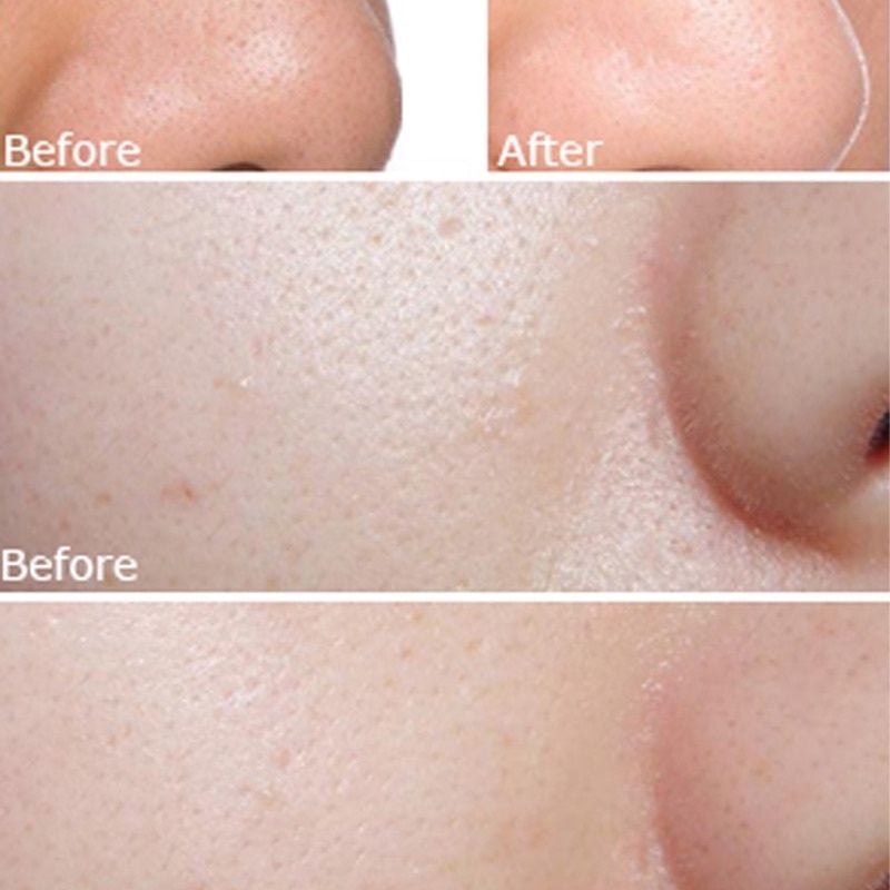 Mặt Nạ Dưỡng Trắng, Cấp Ẩm Cao Cấp Dr.Ci:Labo White C Whitening Nhật Bản Dành Cho Loại Da Khô, Da Mụn  (Hộp 5 Miếng)
