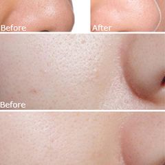 Mặt Nạ Dưỡng Trắng, Cấp Ẩm Cao Cấp Dr.Ci:Labo White C Whitening Nhật Bản Dành Cho Loại Da Khô, Da Mụn  (Hộp 5 Miếng)