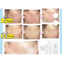 Gel Tẩy Da Chết Dưỡng Trắng Da Bihaku No Bijin Whitening Peel Gel Nhật Bản- 120G